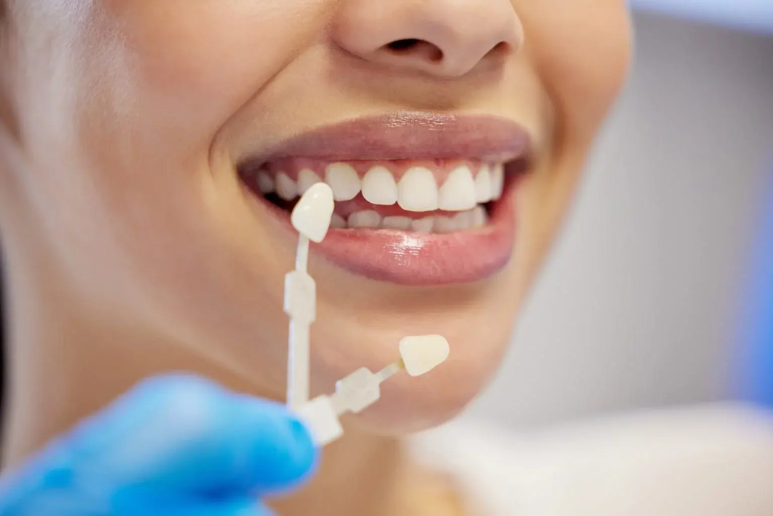 Close-up of a patient's smile as a gloved hand holds a tooth shade guide beside her teeth